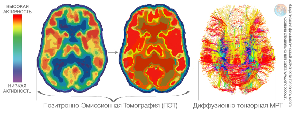 Моя Активность Головного Мозга во время выполнения Вашего Заказа или творческой задачи